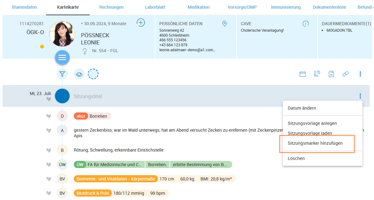 Sitzungsmarker hinzufügen